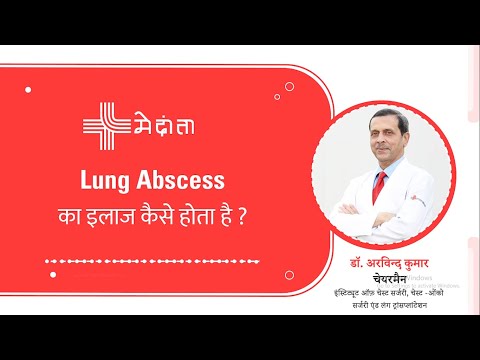 How is Lung Abscess Treated? 